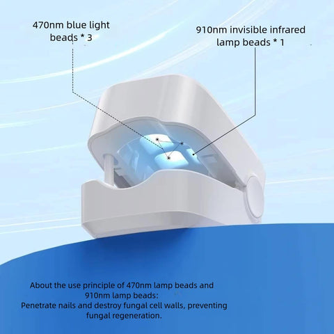 Vital Nails: Nail Fungus Removal Laser Device